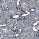STIM1 Antibody in Immunohistochemistry (Paraffin) (IHC (P))