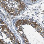 STIM1 Antibody in Immunohistochemistry (Paraffin) (IHC (P))