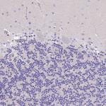 BTN1A1 Antibody in Immunohistochemistry (Paraffin) (IHC (P))