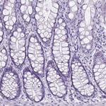 BTN1A1 Antibody in Immunohistochemistry (Paraffin) (IHC (P))