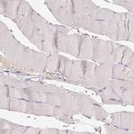 BTN1A1 Antibody in Immunohistochemistry (Paraffin) (IHC (P))