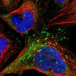 LPP Polyclonal Antibody