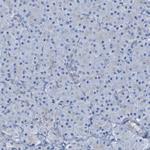 LPP Antibody in Immunohistochemistry (Paraffin) (IHC (P))