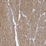 LPP Antibody in Immunohistochemistry (Paraffin) (IHC (P))
