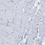 Moesin Antibody in Immunohistochemistry (Paraffin) (IHC (P))