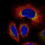 GCNT3 Polyclonal Antibody