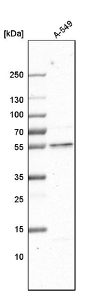 GCNT3 Antibody in Western Blot (WB)
