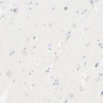 LAT Antibody in Immunohistochemistry (Paraffin) (IHC (P))