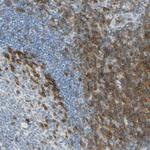 LAT Antibody in Immunohistochemistry (Paraffin) (IHC (P))