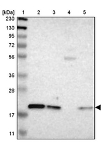 LAT Antibody in Western Blot (WB)
