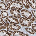 ACMSD Antibody in Immunohistochemistry (Paraffin) (IHC (P))