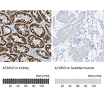 ACMSD Polyclonal Antibody