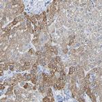 ACMSD Antibody in Immunohistochemistry (Paraffin) (IHC (P))