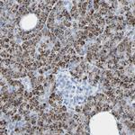 ACMSD Antibody in Immunohistochemistry (Paraffin) (IHC (P))