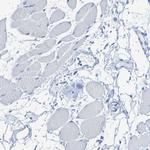 ACMSD Antibody in Immunohistochemistry (Paraffin) (IHC (P))