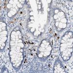 Langerin Antibody in Immunohistochemistry (Paraffin) (IHC (P))