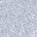 Langerin Antibody in Immunohistochemistry (Paraffin) (IHC (P))
