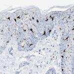 Langerin Antibody in Immunohistochemistry (Paraffin) (IHC (P))