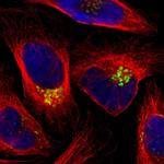 GALNT2 Polyclonal Antibody