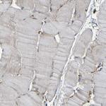 Moesin Antibody in Immunohistochemistry (Paraffin) (IHC (P))