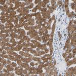ERLIN1 Antibody in Immunohistochemistry (Paraffin) (IHC (P))