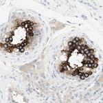 ART3 Antibody in Immunohistochemistry (Paraffin) (IHC (P))