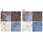 ACSL1 Antibody in Immunohistochemistry (Paraffin) (IHC (P))