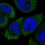 DFNA5 Polyclonal Antibody
