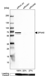 DFNA5 Antibody in Western Blot (WB)