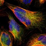 C1rLP Polyclonal Antibody