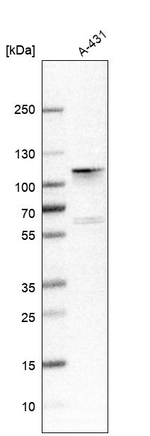 ADAM15 Antibody in Western Blot (WB)