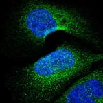 VPARP Polyclonal Antibody