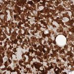 VPARP Antibody in Immunohistochemistry (Paraffin) (IHC (P))