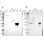 PHYH Antibody in Western Blot (WB)