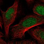 Dot1L Polyclonal Antibody