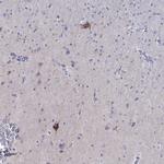 Chromogranin C Antibody in Immunohistochemistry (Paraffin) (IHC (P))