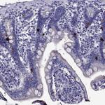 Chromogranin C Antibody in Immunohistochemistry (Paraffin) (IHC (P))