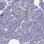 Chromogranin C Antibody in Immunohistochemistry (Paraffin) (IHC (P))