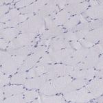 Chromogranin C Antibody in Immunohistochemistry (Paraffin) (IHC (P))