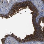 CD151 Polyclonal Antibody