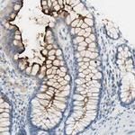 TSPAN1 Antibody in Immunohistochemistry (Paraffin) (IHC (P))