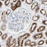 TSPAN1 Antibody in Immunohistochemistry (Paraffin) (IHC (P))