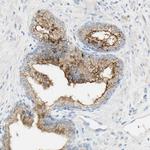 TSPAN1 Antibody in Immunohistochemistry (Paraffin) (IHC (P))