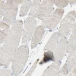 TSPAN1 Antibody in Immunohistochemistry (Paraffin) (IHC (P))