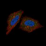 Synaptojanin 1 Polyclonal Antibody