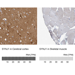 Synaptojanin 1 Antibody in Immunohistochemistry (Paraffin) (IHC (P))