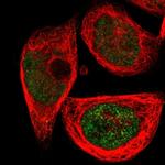 SGCG Polyclonal Antibody