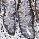 RRBP1 Antibody in Immunohistochemistry (Paraffin) (IHC (P))