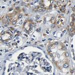 RRBP1 Antibody in Immunohistochemistry (Paraffin) (IHC (P))