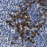 RRBP1 Antibody in Immunohistochemistry (Paraffin) (IHC (P))
